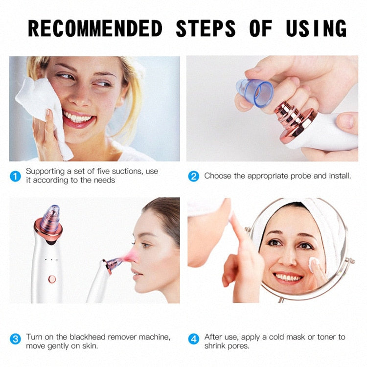 Facial Blackhead Remover